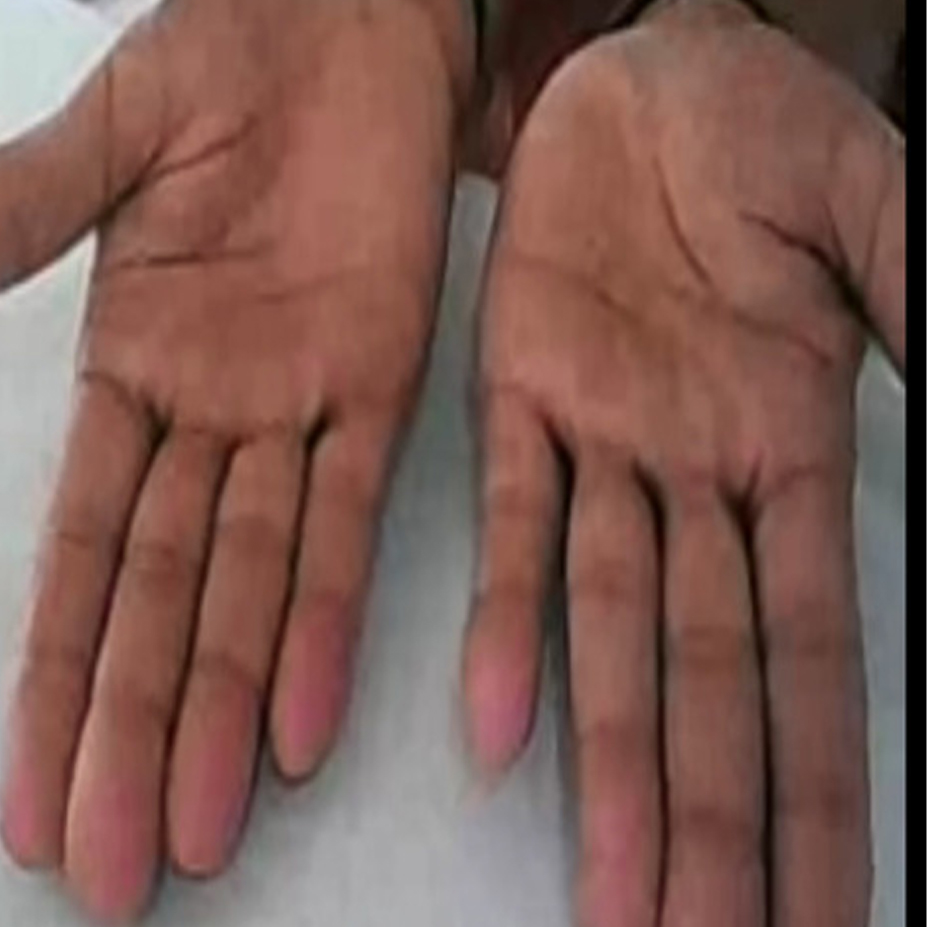 After Image