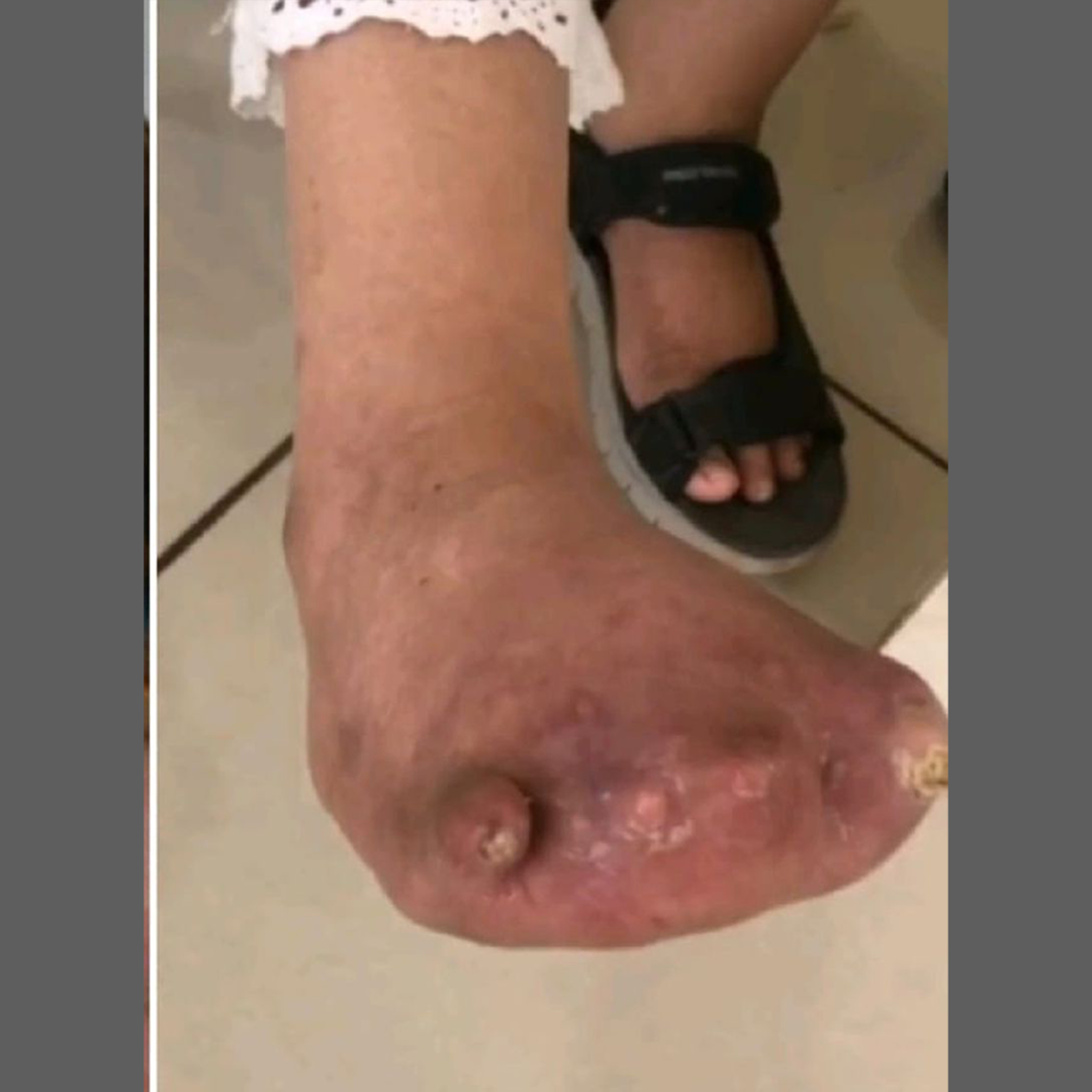 After Image